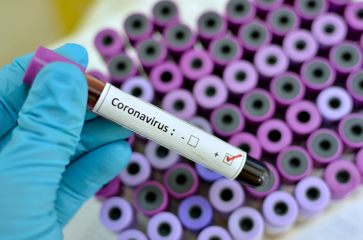 Instrukcija Islamske zajednice za postupanje u slučajevima širenja koronavirusa